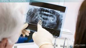 رادیوگرافی در دندانپزشکی