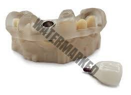 دوره های جراحی هدایت شده ایمپلنت دندانی